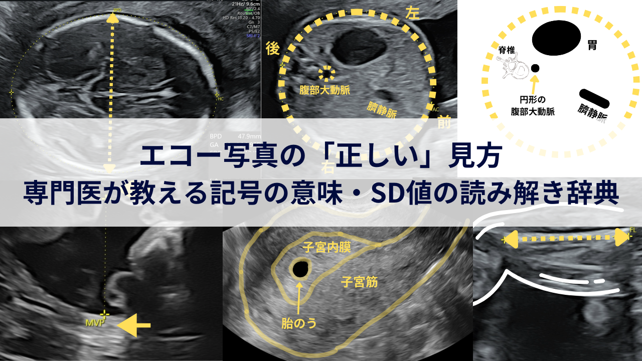 エコー 写真 見方 用語